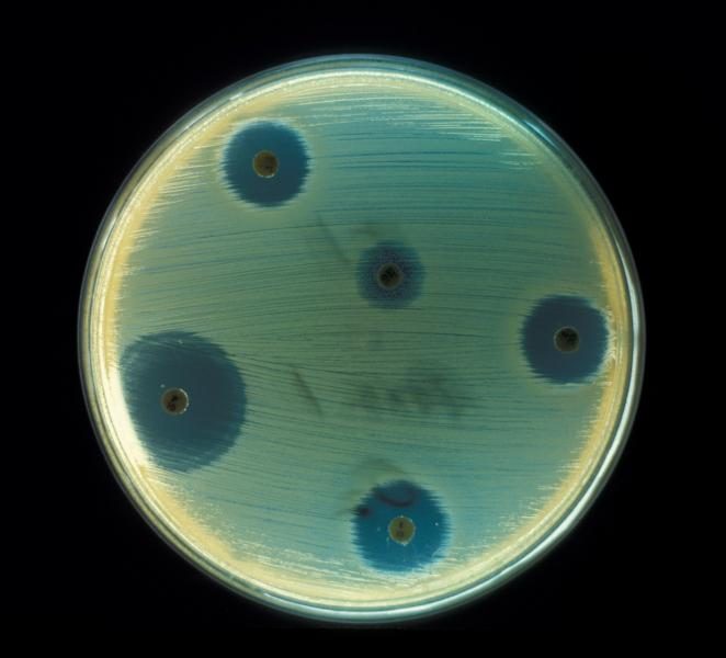 staphylococcus_aureus_28ab_test29-3725096