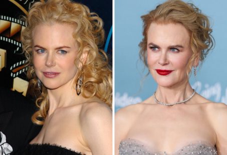 nicole-kidman-plastic-surgery-6621450