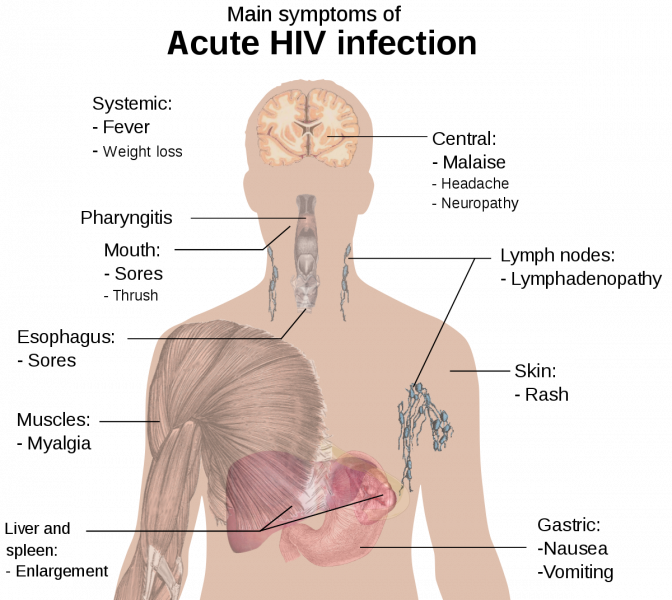 1200px-symptoms_of_acute_hiv_infection-svg_-6829714