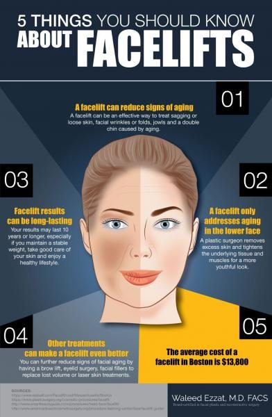 5-things-you-should-know-about-facelifts-3503769