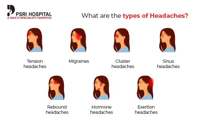 what-are-the-types-of-headache-6553651