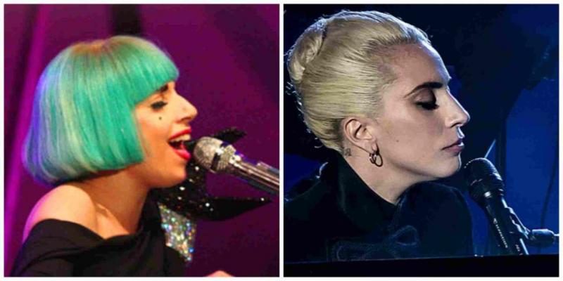 lady-gaga-nose-before-and-after-1-1024x512-2338544