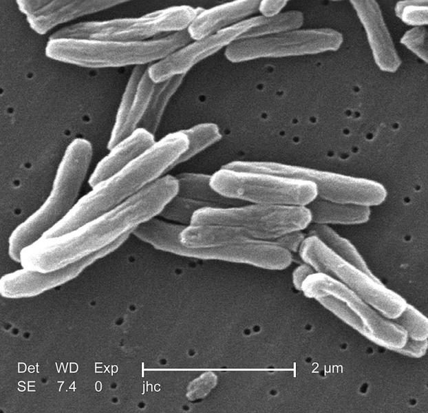 800px-mycobacterium_tuberculosis-6550849