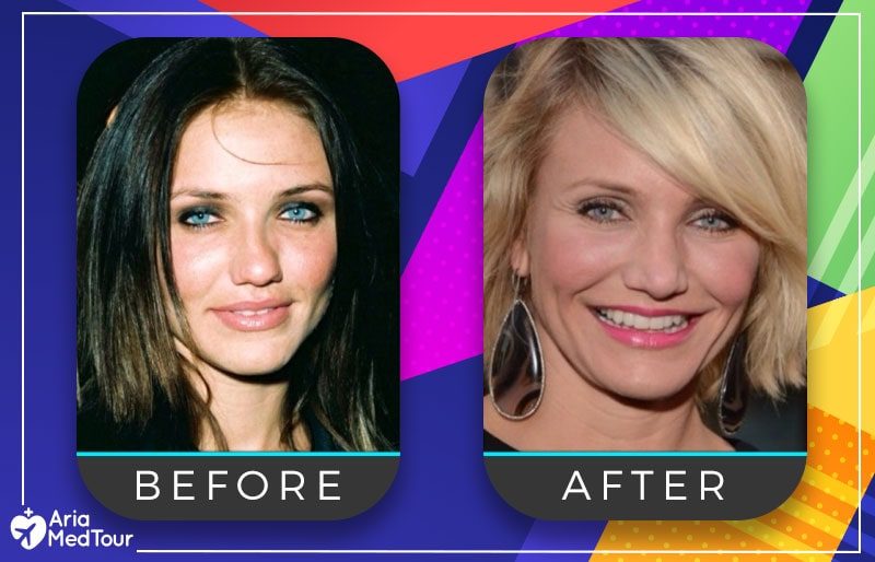 cameron-diaz-nose-job-before-after-5898254