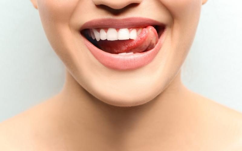 teeth-care-1080x675-5055328