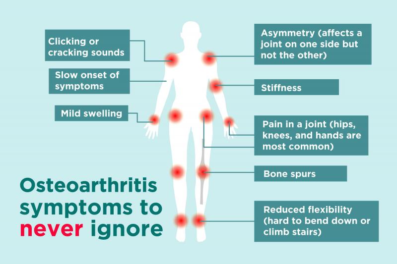 Los primeros signos de artritis que mucha gente ignora