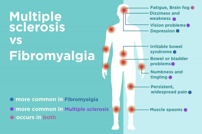 Esclerosis múltiple: síntomas