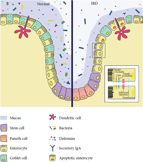 Gastritis: causas psicosomáticas