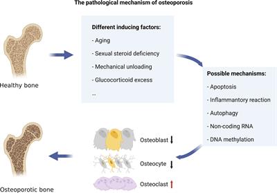 Punto de inflexión: todo sobre el tratamiento de la osteoporosis