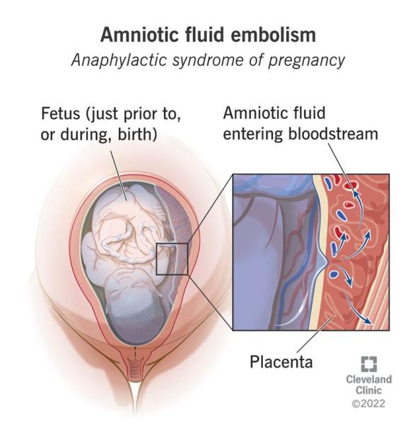 undefinedFortunately, there are several treatment options available to restore health and alleviate the symptoms of postcoccygeal syndrome. Estos pueden incluir: