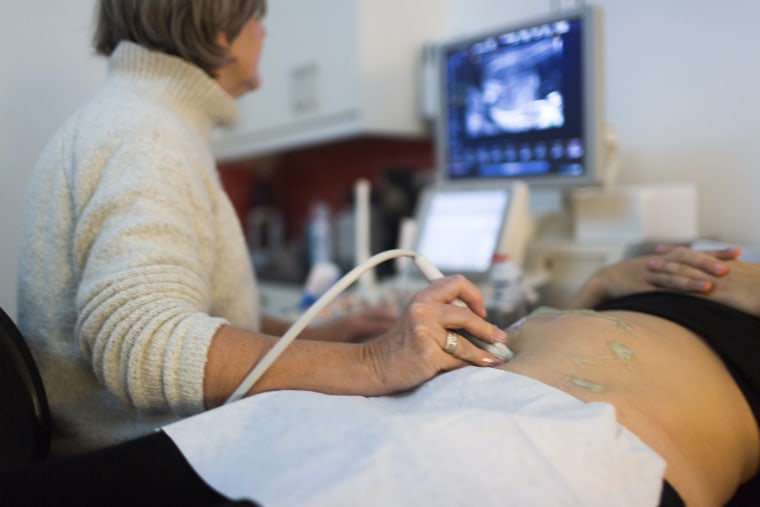 Cirugía de cesárea: lo que debe saber sobre el parto inducido