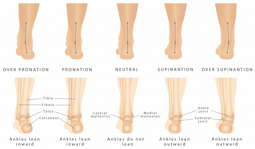 10 preguntas que debe hacer a un traumatólogo: con qué frecuencia usar tacones de aguja, si es correcto crujirse los dedos y si debe comprar un andador para su hijo.