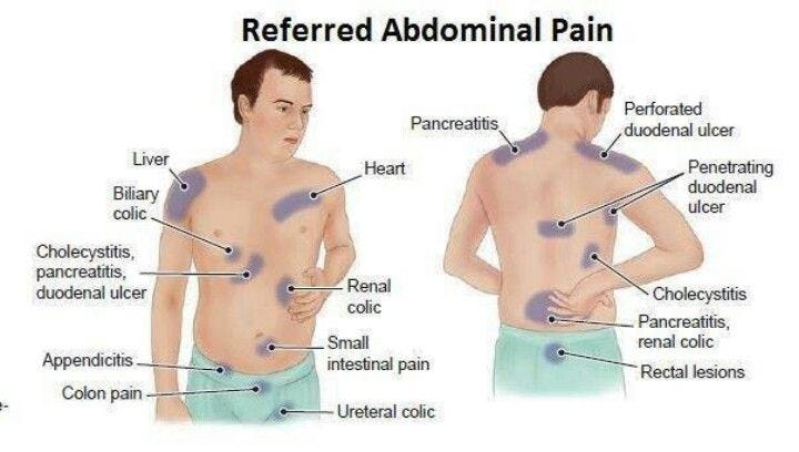 ¿Cómo tratar el síndrome del intestino irritable?