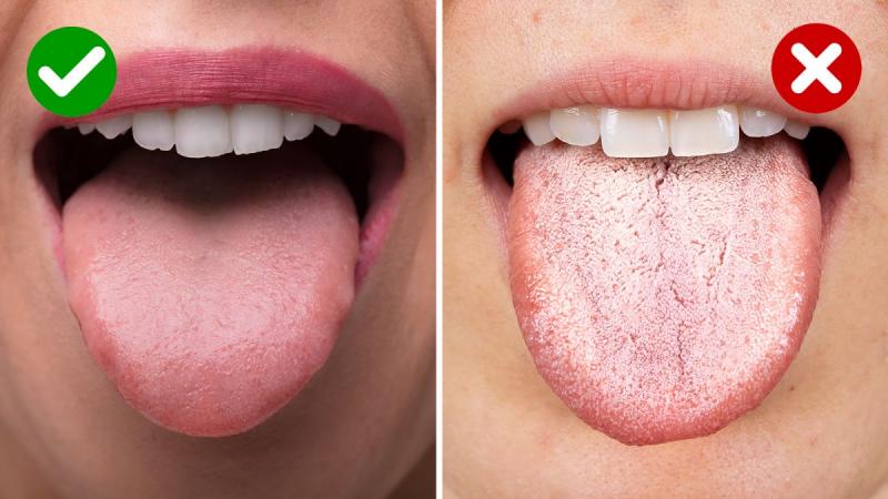 ¿Cómo determinar la salud a partir de la lengua?