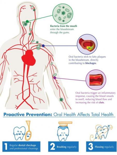 En general, la relación entre los dientes en mal estado y la salud del corazón es un problema grave. Cuidar su salud dental, como cepillarse los dientes y usar hilo dental con regularidad, no sólo puede ayudarle a mantener una sonrisa sana, sino también a proteger su corazón.