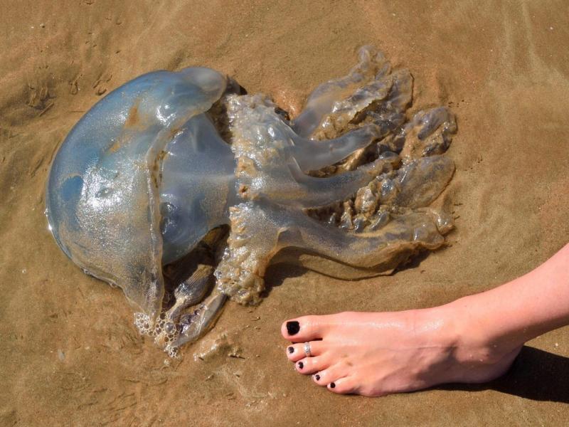 Qué aspecto tiene una quemadura de medusa