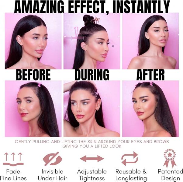 ¿Qué tiene de malo un lifting facial convencional?