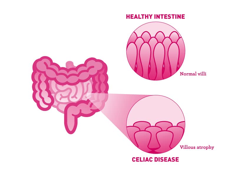 1. 2. Daño intestinal