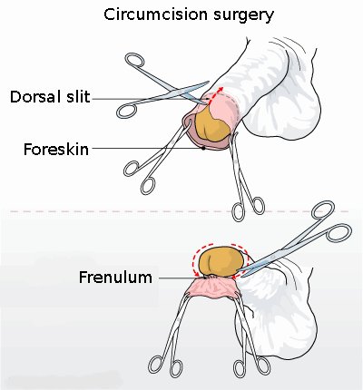 2. Dispositivos de tracción