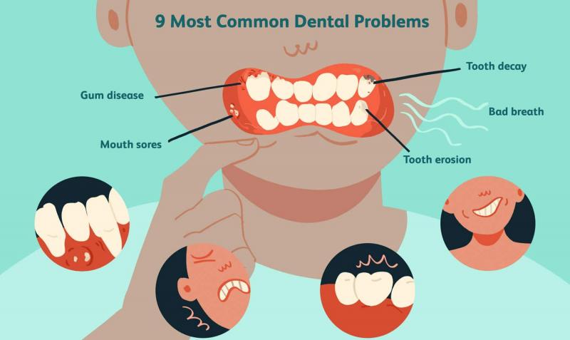 undefined6. Llagas en la boca: Las úlceras bucales persistentes que no cicatrizan pueden ser un síntoma de cáncer oral o de otras afecciones bucodentales graves. El diagnóstico y el tratamiento precoces son vitales para un resultado positivo.