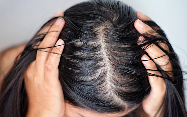 1. Por qué el cuero cabelludo se engrasa rápidamente: 4 razones 