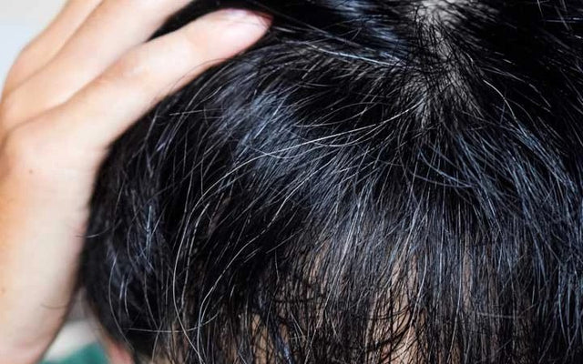 2 emociones fuertes que provocan la caída del cabello y las canas