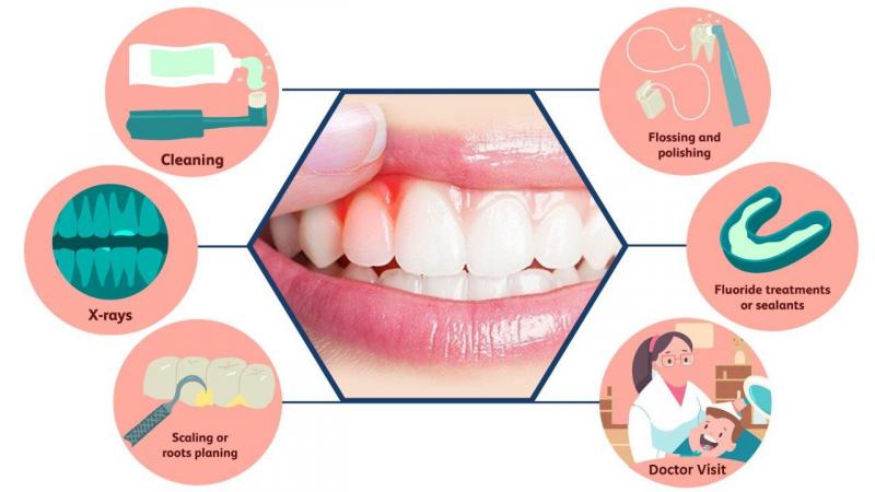 Tipos de gingivitis