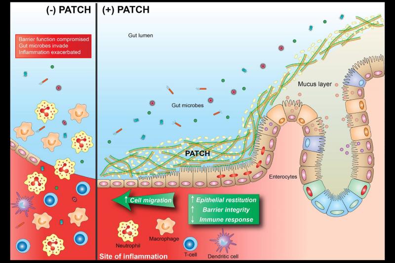 Los científicos acaban de desarrollar un probiótico revolucionario que puede revolucionar el diagnóstico de las enfermedades intestinales. Este enfoque innovador puede proporcionar un método más preciso y eficaz para detectar y controlar diversas afecciones del aparato digestivo.