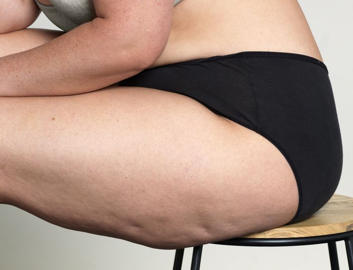 Esa piel de naranja: 4 formas nuevas y 5 probadas de combatir la celulitis