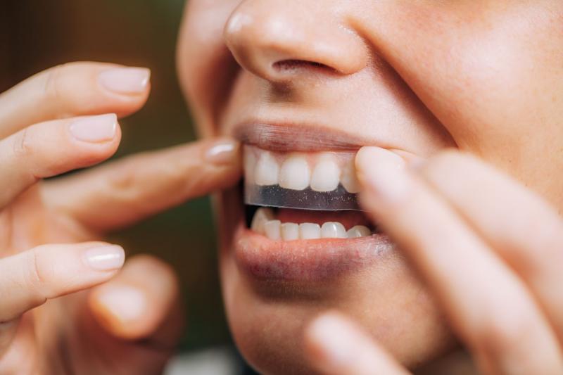 Cómo blanquear los dientes de forma rápida y eficaz