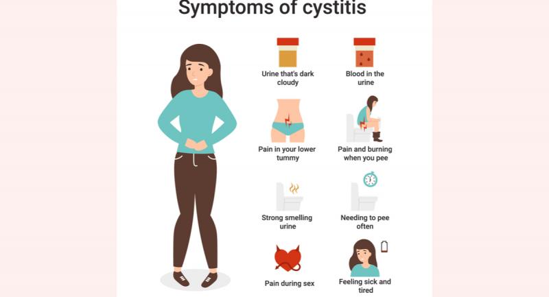 Signos de cistitis en la mujer