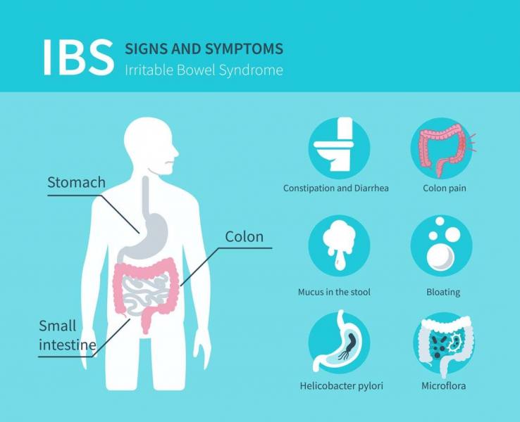 Cómo prevenir las exacerbaciones del síndrome del intestino irritable durante las fiestas