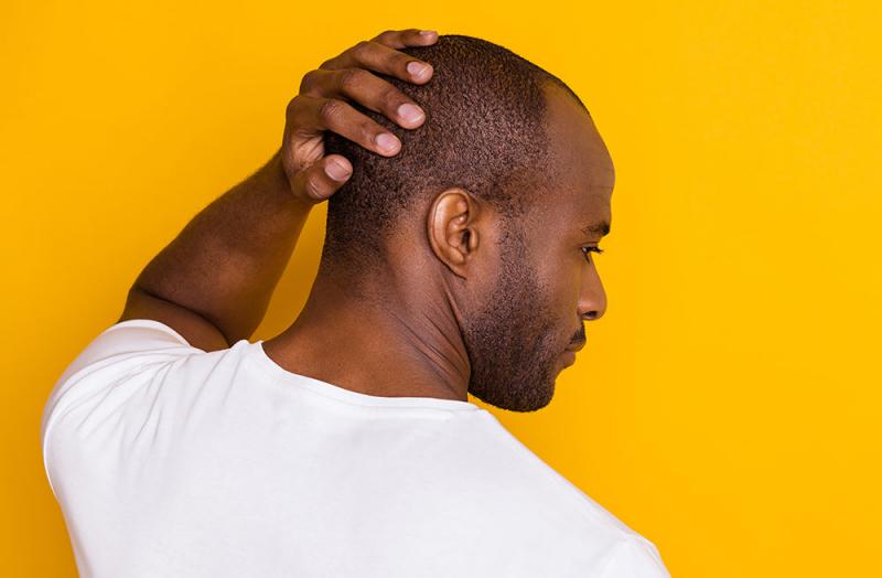 Caída del cabello: causas y 8 formas reales de frenarla