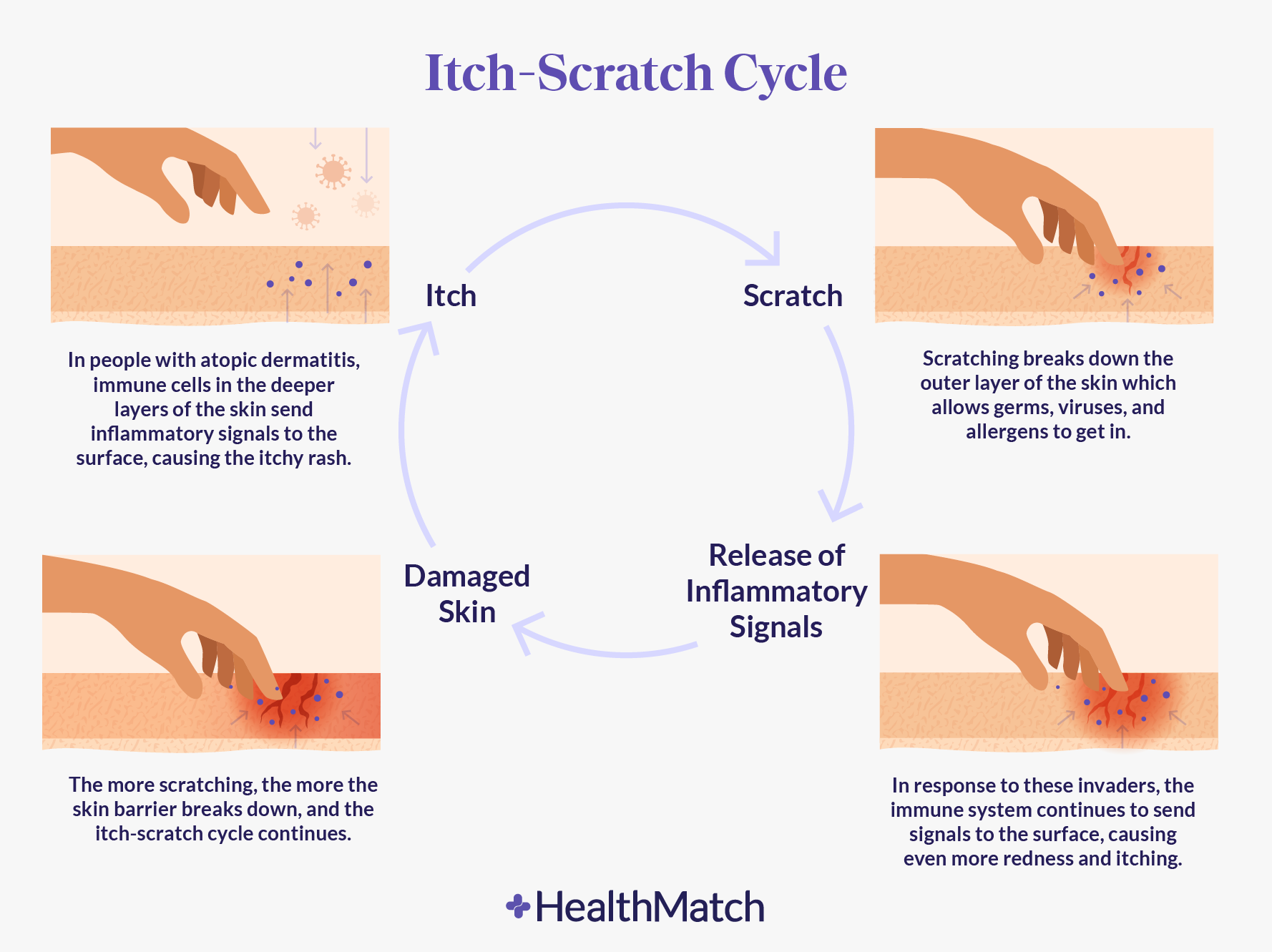 ¿Cuál es el origen de la dermatitis?