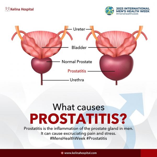 Por último, pero no por ello menos importante, caminar con dobladillos en invierno también puede exponer a los hombres al riesgo de padecer prostatitis. El aire frío puede afectar al flujo sanguíneo de la región pélvica, provocando la inflamación de la glándula prostática. Esto puede causar síntomas como dolor y dificultad para orinar y, en algunos casos, puede requerir tratamiento médico.