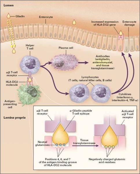 3. Síntomas no intestinales