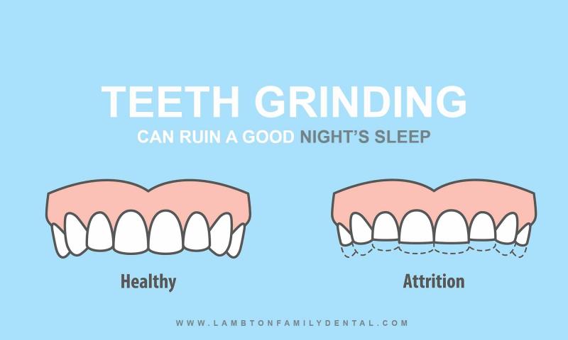 Por qué una persona rechina los dientes mientras duerme (¿hay algún motivo peligroso entre las causas)