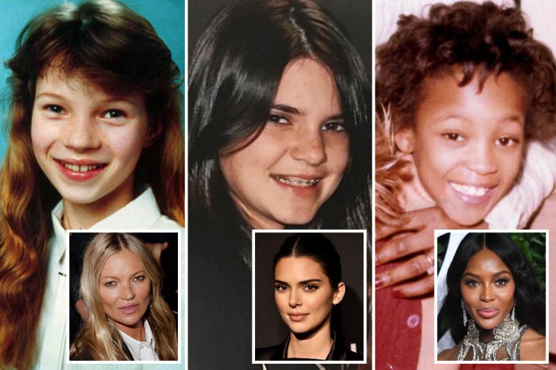 Piel de supermodelo: Kendall Jenner, Kate Moss y otras estrellas revelan sus secretos