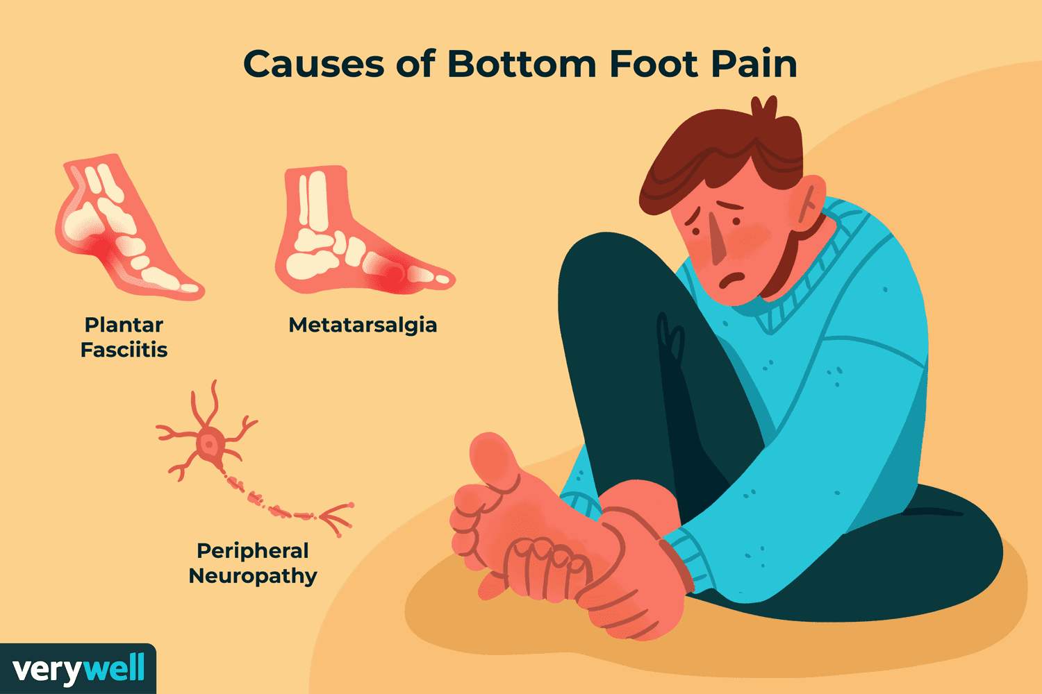 Si le duele el pie al caminar: 6 causas principales, tratamiento y prevención