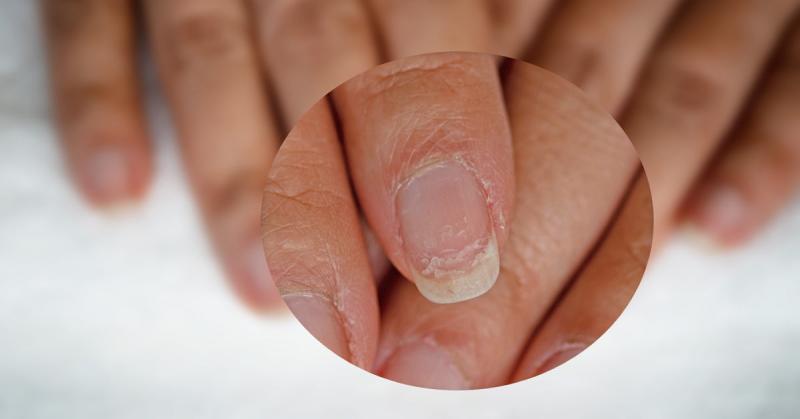5 razones por las que se te rompen las uñas (y no son sólo las vitaminas)