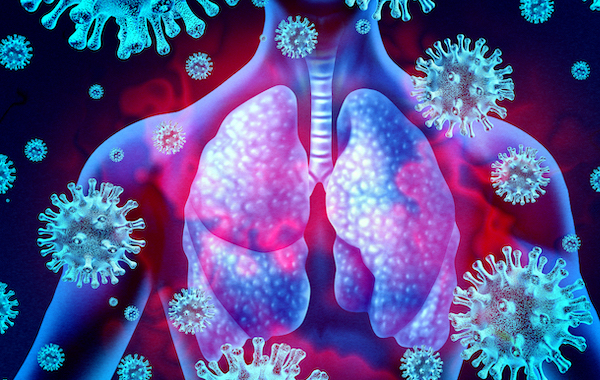 Cómo distinguir el coronavirus de las infecciones víricas respiratorias agudas (explicado por un médico)