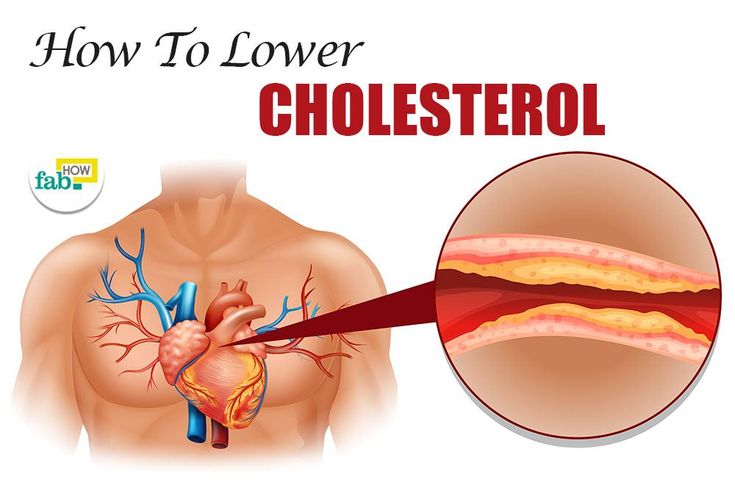 Cómo reducir el colesterol: 8 maneras (sin tomar medicamentos)