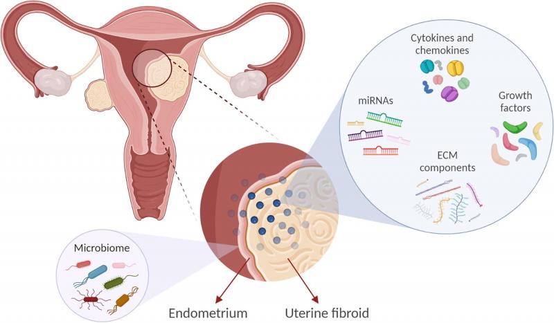 Histerectomía abdominal