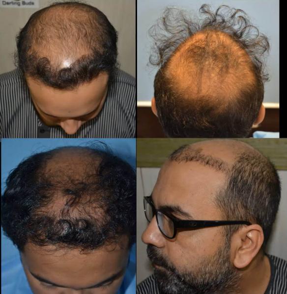 3 Recuperación del cabello en casa: mascarillas y tratamientos con aceite