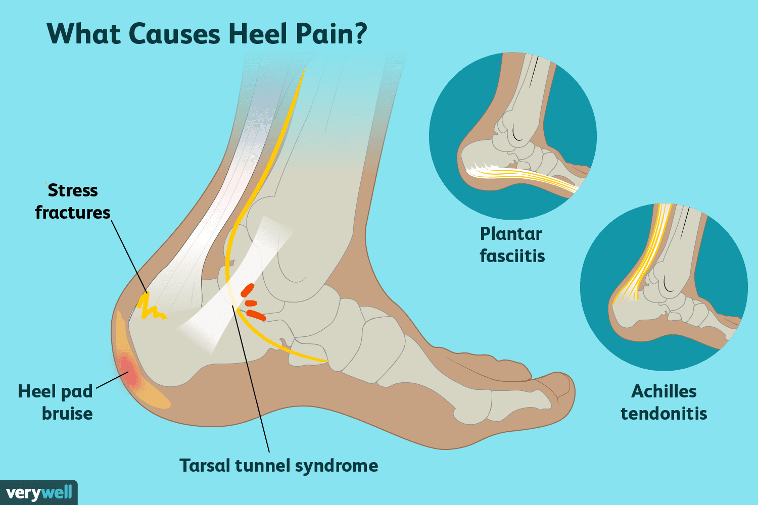 Por qué duelen los tacones: las 6 causas más comunes (contadas por un experto)