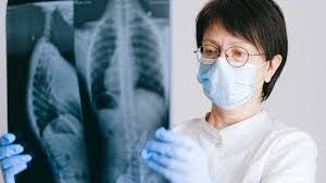 La comunidad médica lleva años buscando formas eficaces de regenerar el tejido pulmonar y restablecer la función pulmonar. Este descubrimiento reciente ofrece esperanza a millones de pacientes de todo el mundo afectados por enfermedades pulmonares debilitantes. El equipo de investigadores ha identificado una proteína clave, conocida como undefined[nombre de la proteína] , que desempeña un papel crucial en el proceso de regeneración.