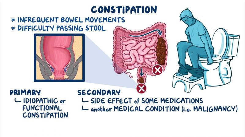 Contraindicaciones para tomar laxantes: