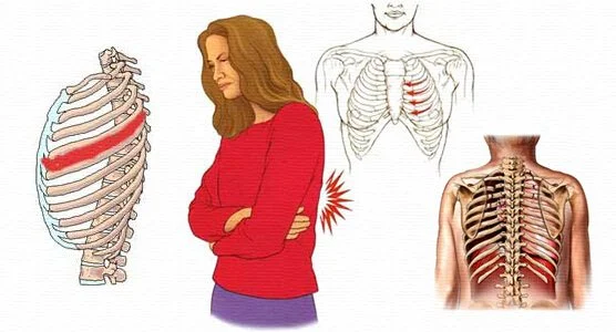 Dificultad para respirar: qué es la neuralgia intercostal (sus síntomas y tratamiento)