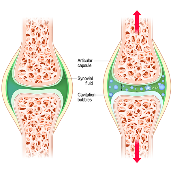 2. 3. Artritis reumatoide