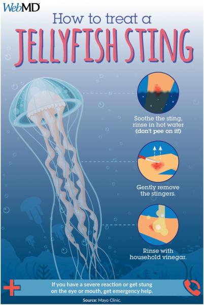 Armado y peligroso: qué hacer si te quemas con una medusa
